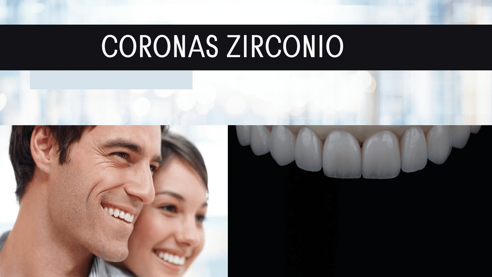 Coronas dentales de Zirconio