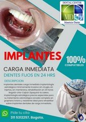 implantes dentales