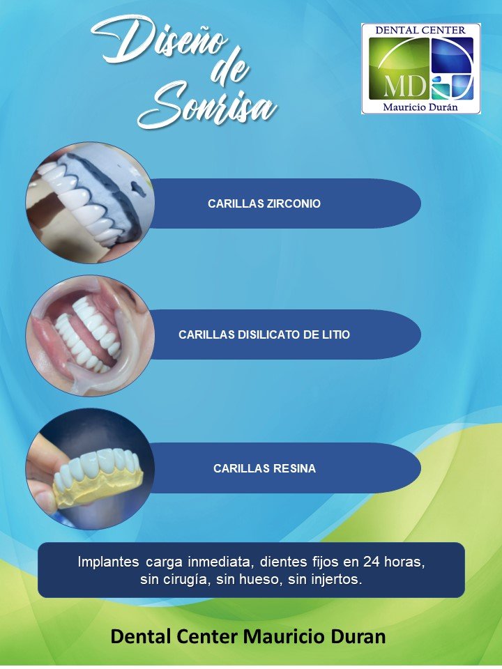 carillas dentales diseño de sonrisa