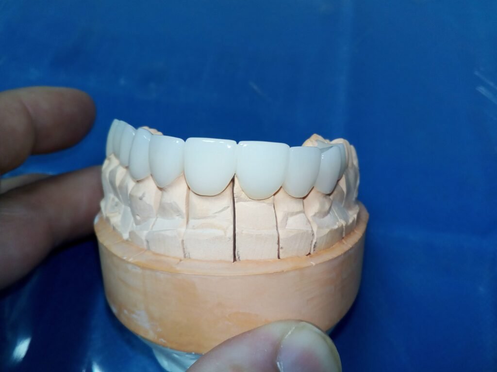 CORONAS DENTALES EN ZIRCONIO DENTAL