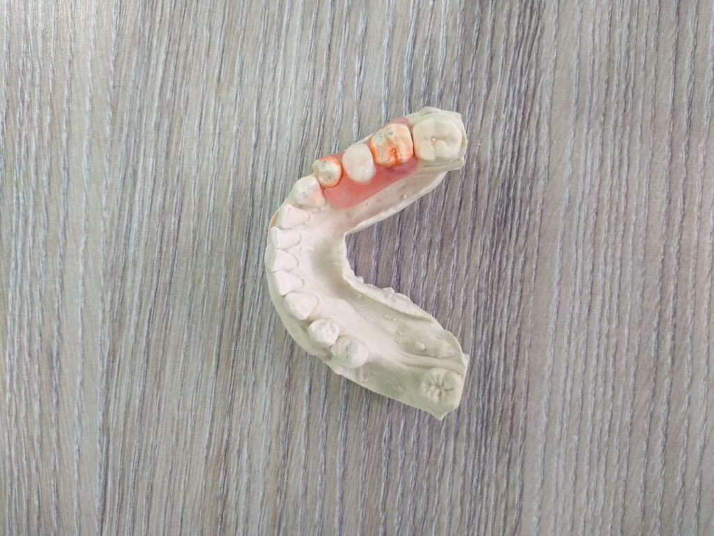 PROTESIS DENTAL AKERS SUPERIOR