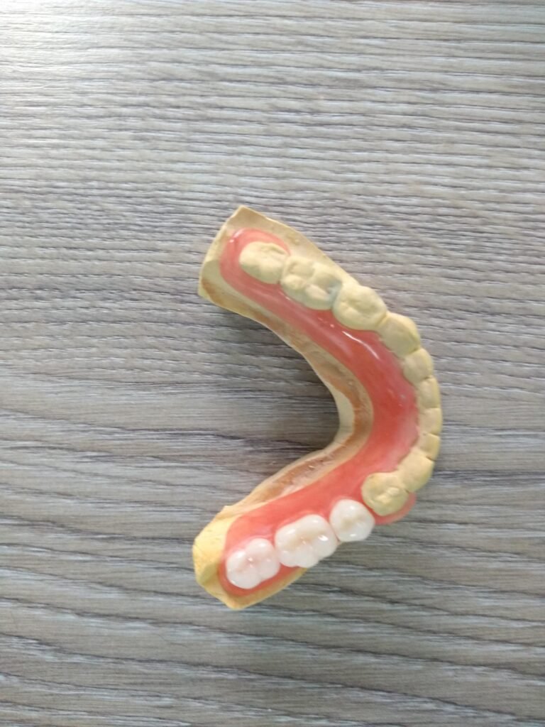 PROTESIS DENTAL PARCIAL INFERIOR