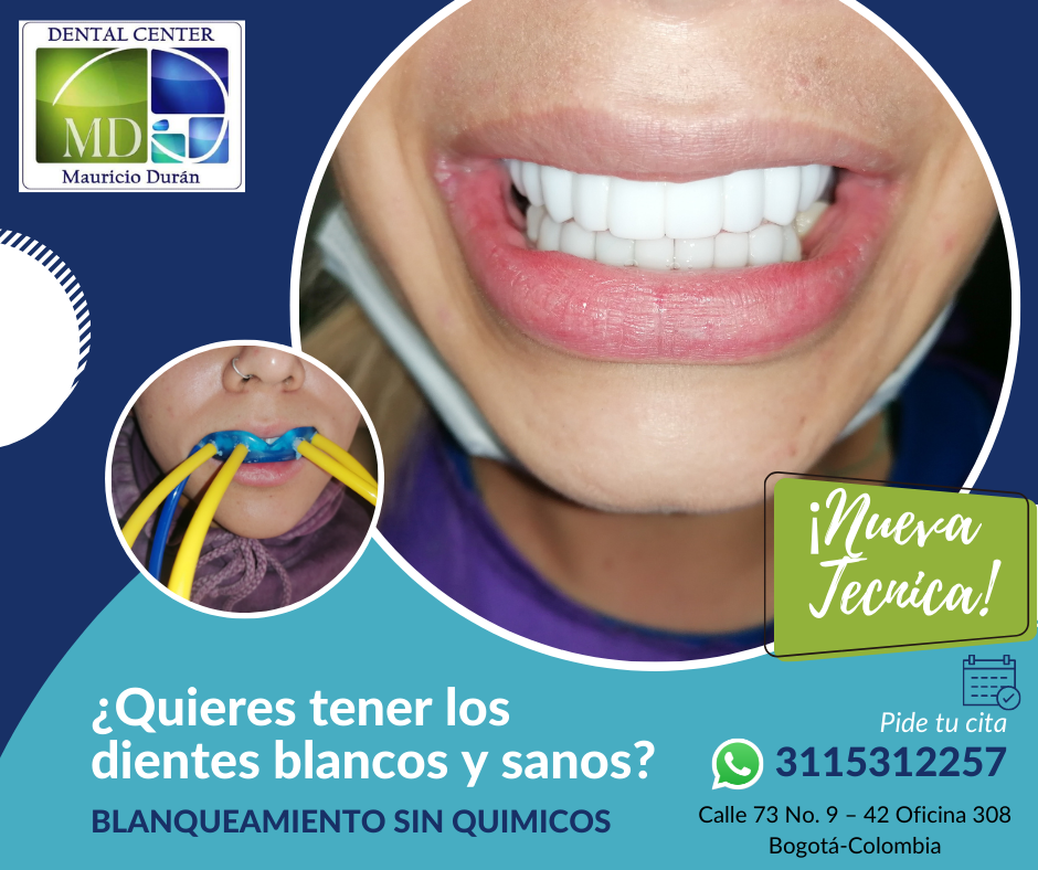 blanqueamiento sin quimicos con ozono terapia dental