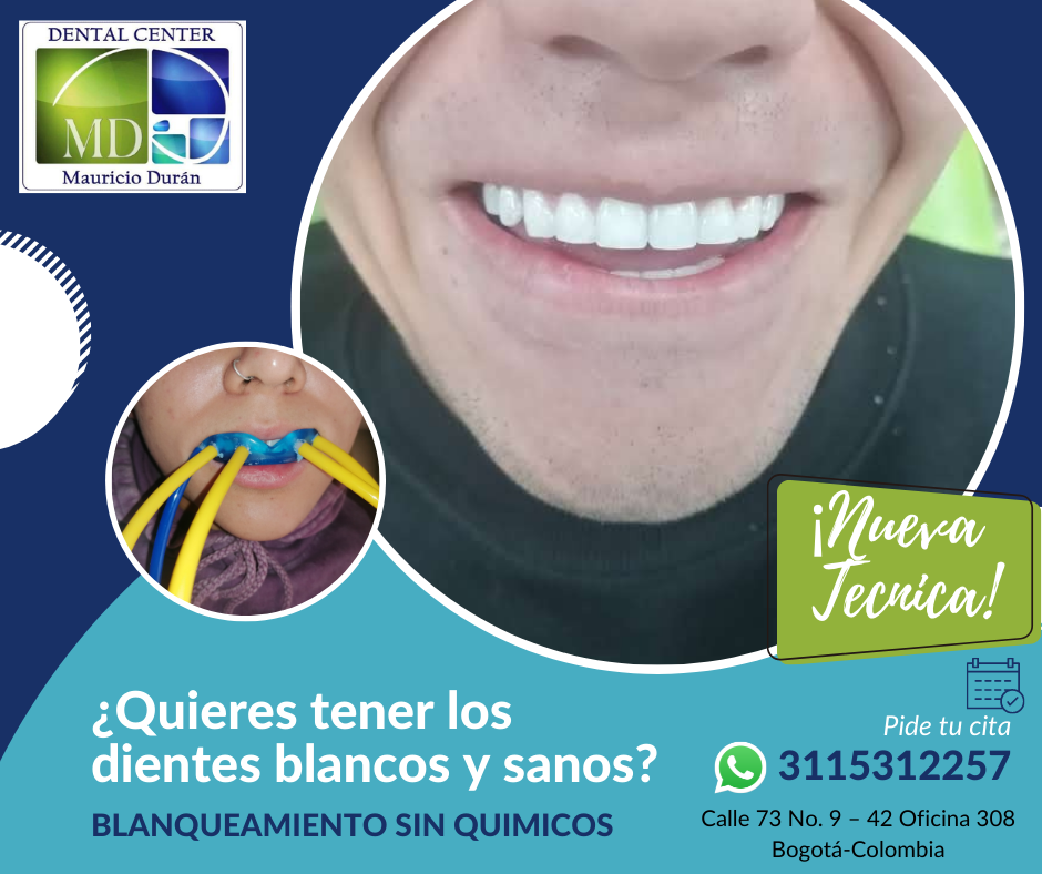 blanqueamiento sin quimicos con ozono natural