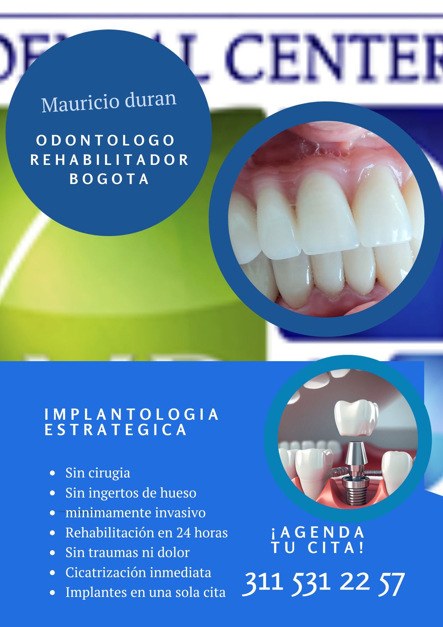 foto implantes dentales