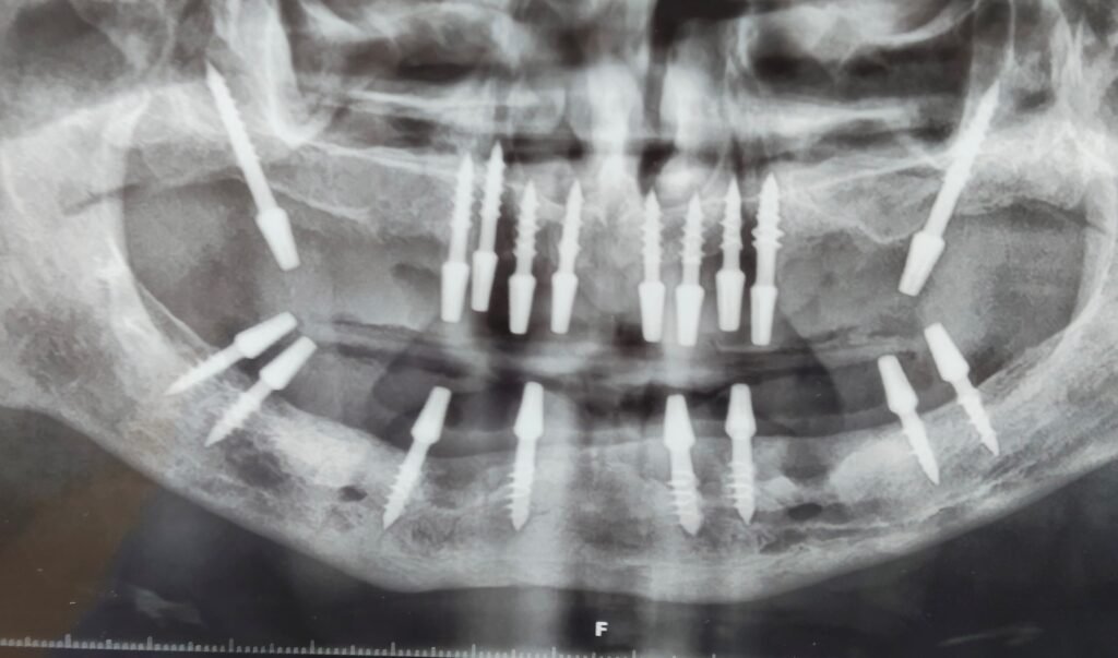radiografia basales sup e inf