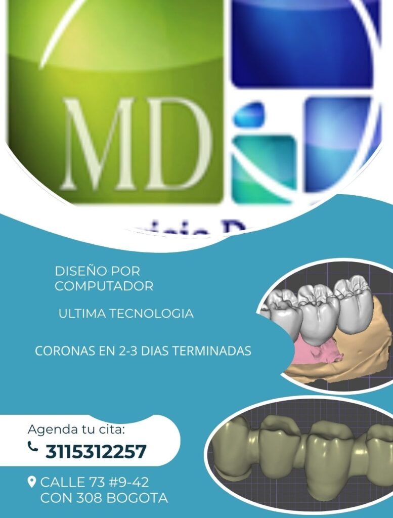 DISEÑO DE CORONAS DENTALES ULTIMA TECNOLOGIA