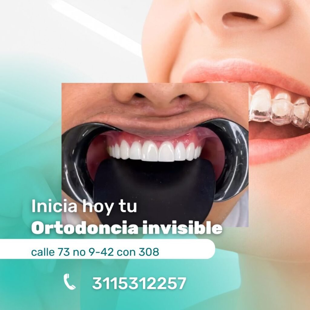 placas invisiling ortodoncia invisible sin brackets